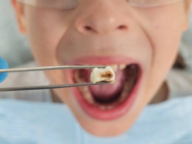 Best Emergency Gum Treatment in Fort Lee, NJ